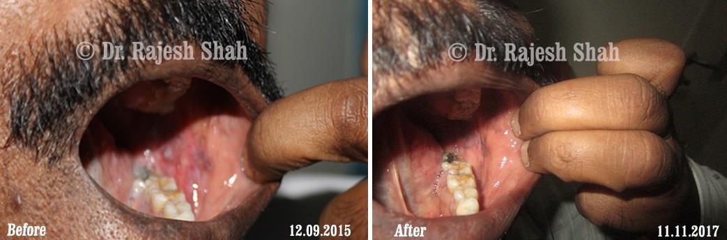 lifeforce homeopathy case-photos